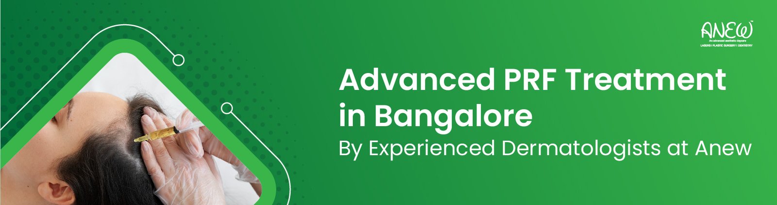 Prf treatment in Bangalore